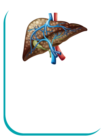 लिवर सिरोसिस